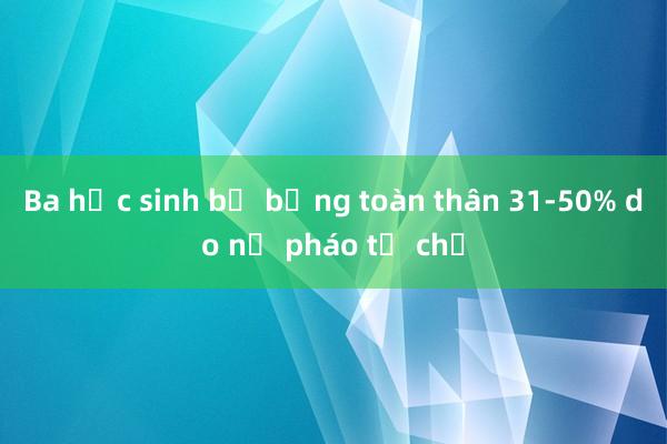 Ba học sinh bị bỏng toàn thân 31-50% do nổ pháo tự chế